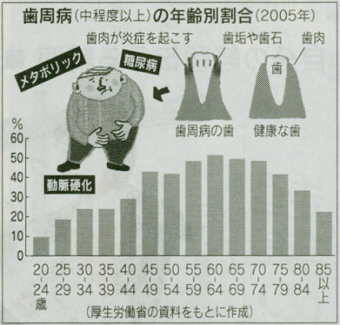 歯周病の年齢別割合